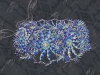 spinobifidae-057