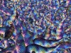 spinobifidae-026