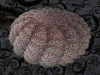 spinobifidae-031