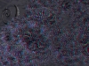 spinobifidae-046