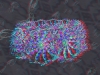 spinobifidae-057