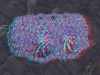spinobifidae-058