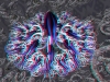 spinobifidae-011