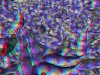 spinobifidae-026