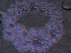 spinobifidae-032